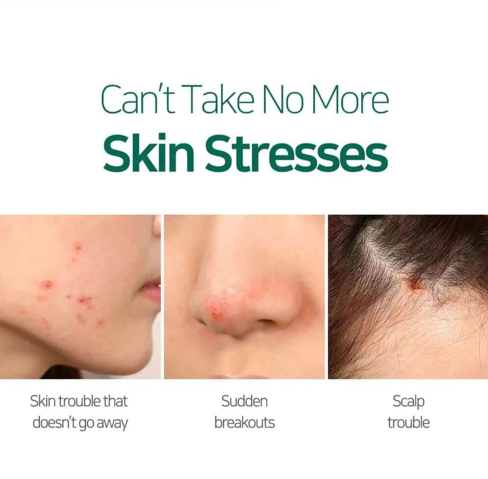SOS līdzeklis Some By Mi 30 days Miracle Tea Tree Clear Spot Oil