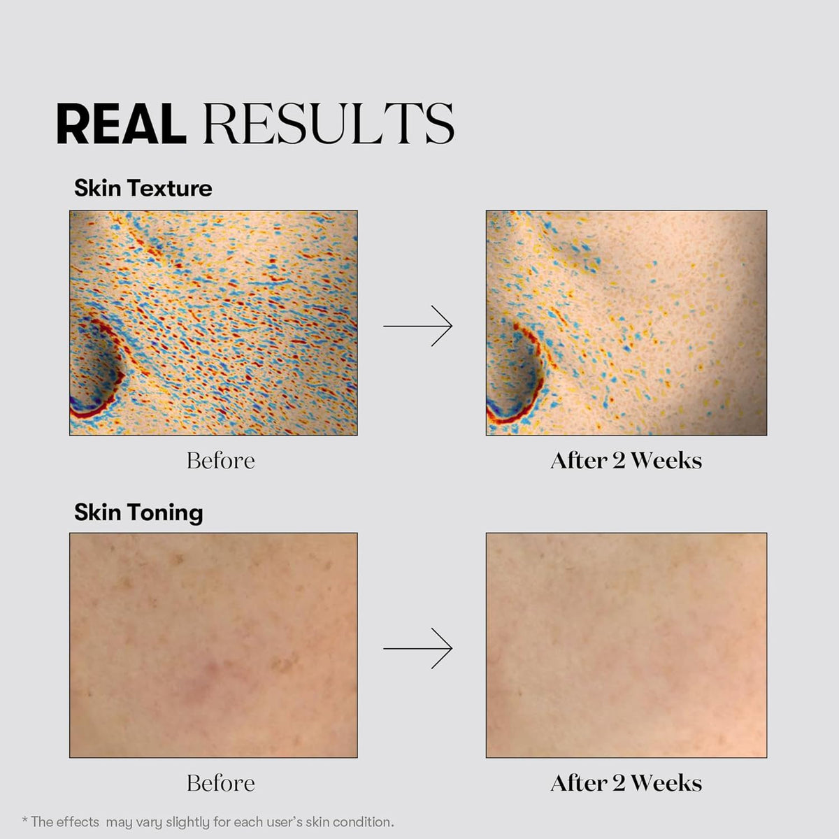 Kapsulu esence pigmentācijas plankumu novēršanai VT Cosmetics TX-Toning Essence 1000 Shot