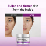 Liftinga krēms ar mikroadatām VT Cosmetics Reedle Shot Lifting Cream