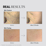 Kapsulu esence pigmentācijas plankumu novēršanai VT Cosmetics TX-Toning Essence 1000 Shot